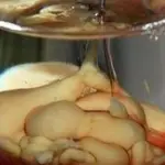 Коктейль Опухоль мозга